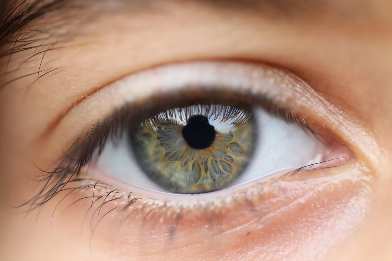 igenics Support igenics for Vision
